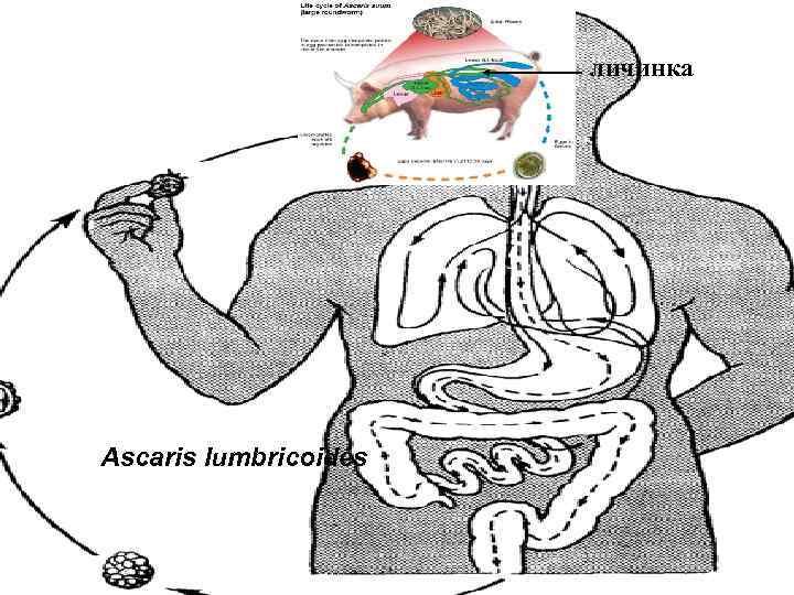     личинка Ascaris lumbricoides 