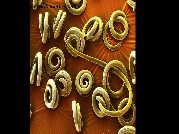 Ascaris lumbricoides 
