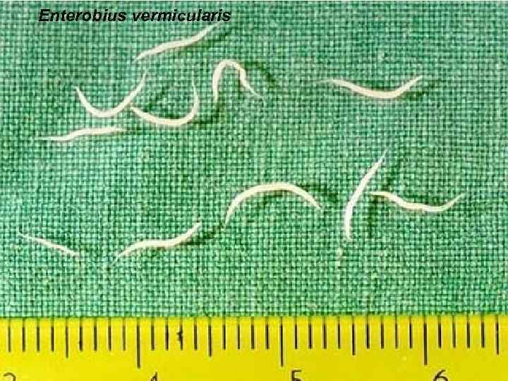 Enterobius vermicularis 