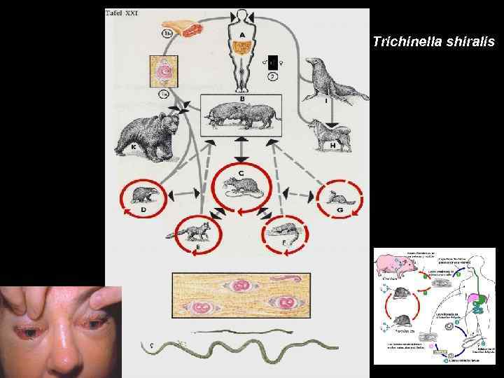 Trichinella shiralis 