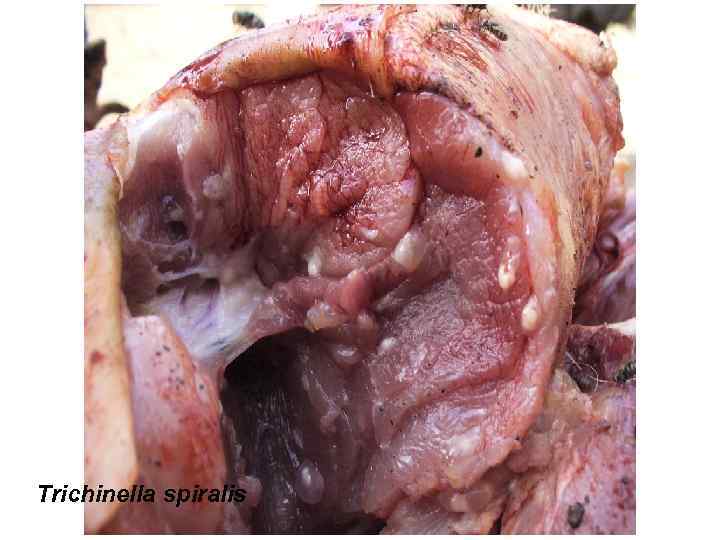 Trichinella spiralis 