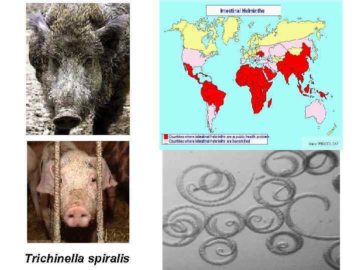 Trichinella spiralis 