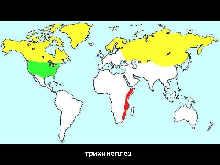 трихинеллез 