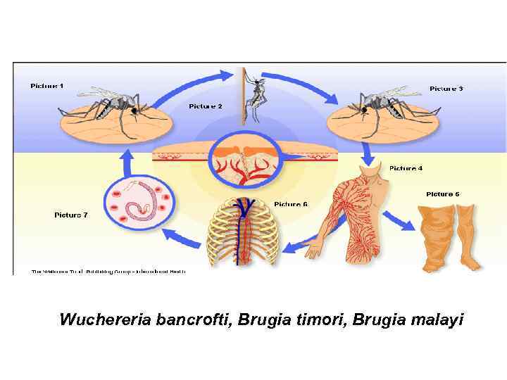 Wuchereria bancrofti, Brugia timori, Brugia malayi 