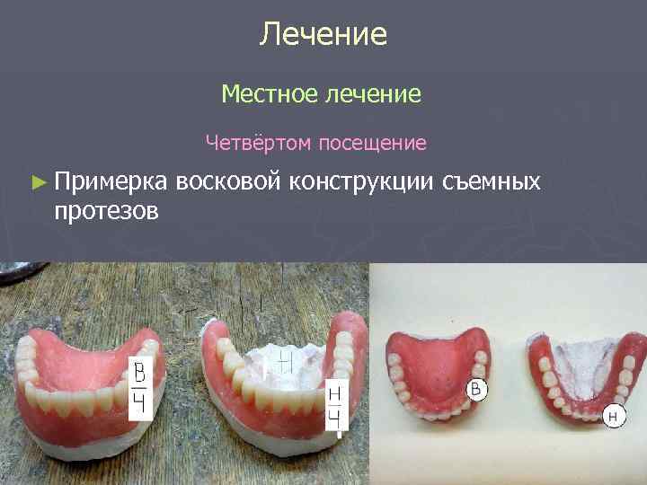 Лечение Местное лечение Четвёртом посещение Лечение Местное лечение Четвёртом посещение