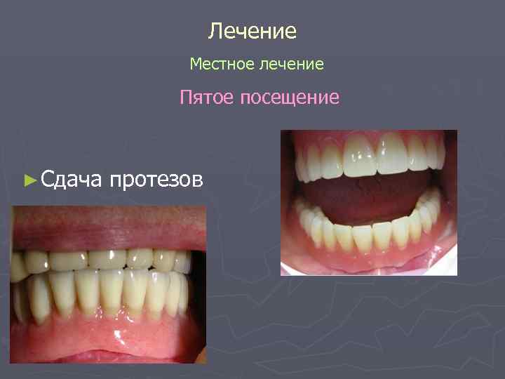 Лечение Местное лечение Пятое посещение Лечение Местное лечение Пятое посещение