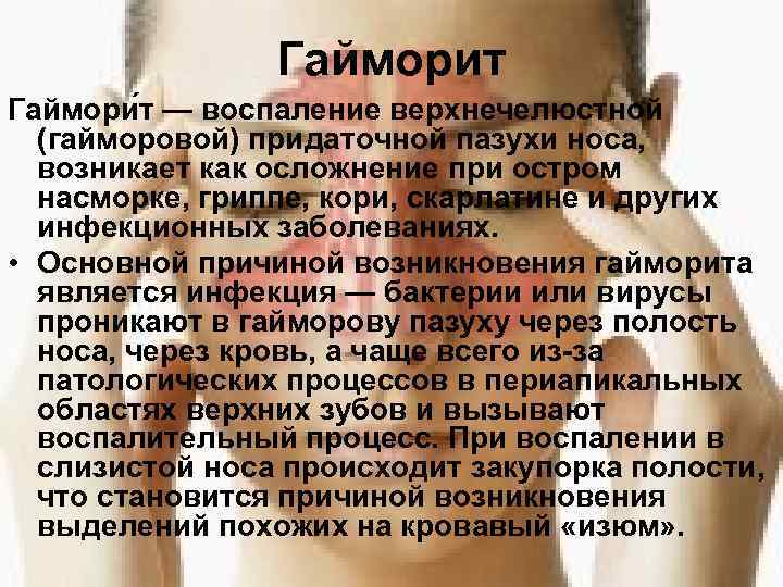     Гайморит Гаймори т — воспаление верхнечелюстной  (гайморовой) придаточной пазухи