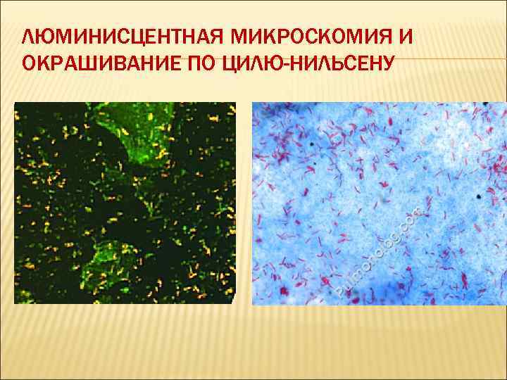 Граму циль. Окраска по Цилю-Нильсену микробиология. Окраска спор по Цилю. Споры бацилл по Цилю Нильсену. Окраска по методу Циля-Нильсена и Ожешко.