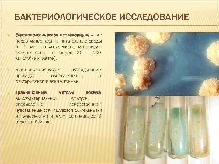   БАКТЕРИОЛОГИЧЕСКОЕ ИССЛЕДОВАНИЕ Ø  Бактериологическое исследование – это посев материала на питательные