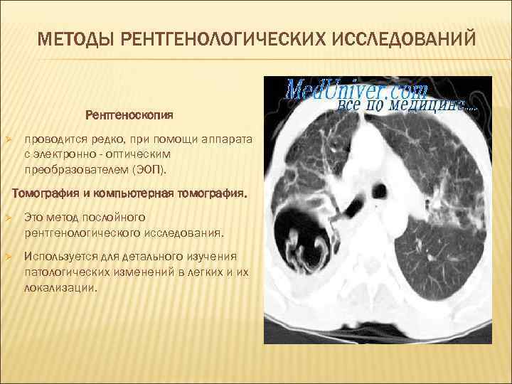  МЕТОДЫ РЕНТГЕНОЛОГИЧЕСКИХ ИССЛЕДОВАНИЙ   Рентгеноскопия Ø  проводится редко, при помощи аппарата