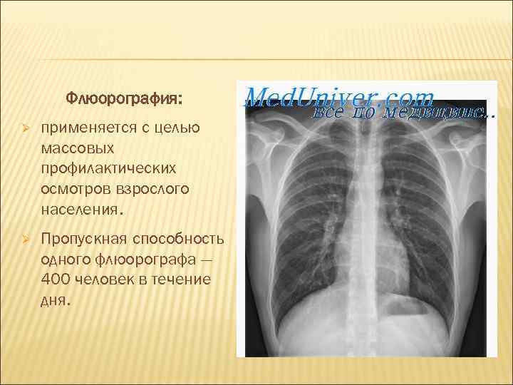   Флюорография: Ø  применяется с целью массовых профилактических осмотров взрослого населения. Ø