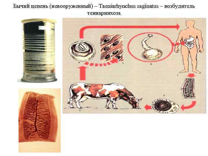 Свиной цепень сколько