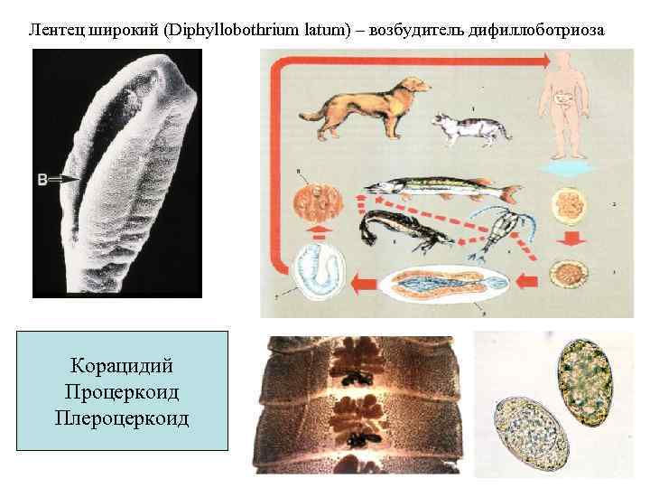 Лентец широкий (Diphyllobothrium latum) – возбудитель дифиллоботриоза   Корацидий Процеркоид  Плероцеркоид 