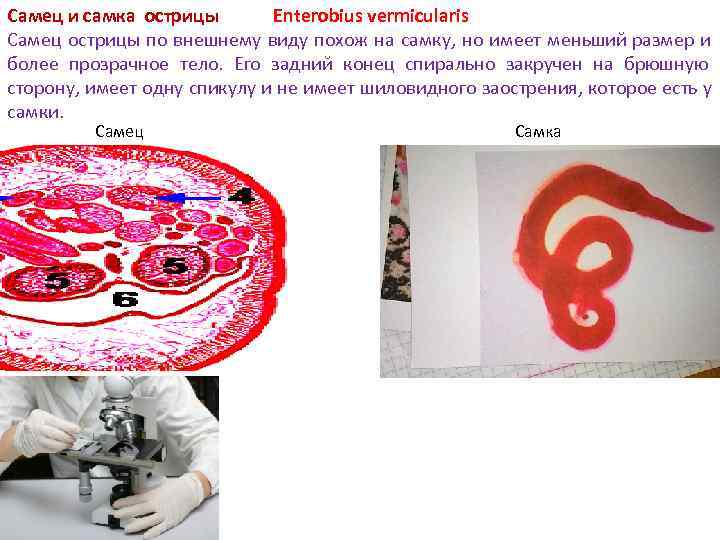 Самец и самка острицы Enterobius vermicularis Самец острицы по внешнему виду похож на Самец и самка острицы Enterobius vermicularis Самец острицы по внешнему виду похож на