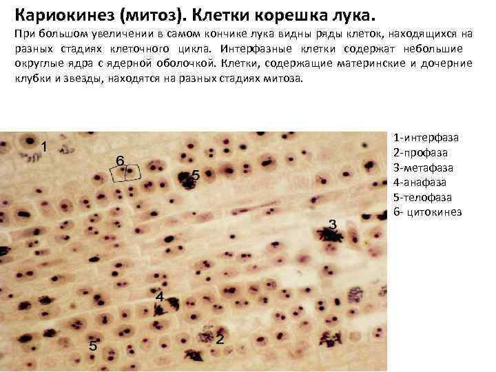 Кариокинез (митоз). Клетки корешка лука. При большом увеличении в самом кончике лука видны Кариокинез (митоз). Клетки корешка лука. При большом увеличении в самом кончике лука видны