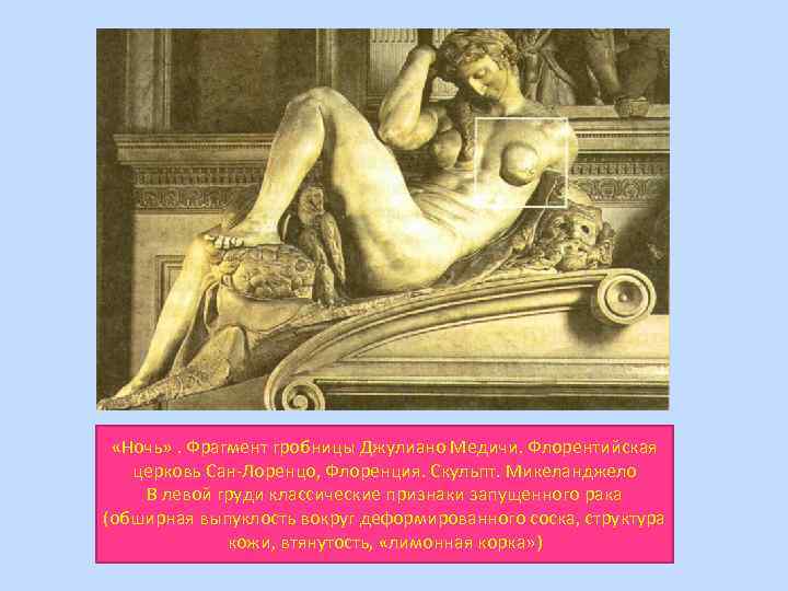  «Ночь» . Фрагмент гробницы Джулиано Медичи. Флорентийская церковь Сан-Лоренцо, Флоренция. Скульпт. Микеланджело В