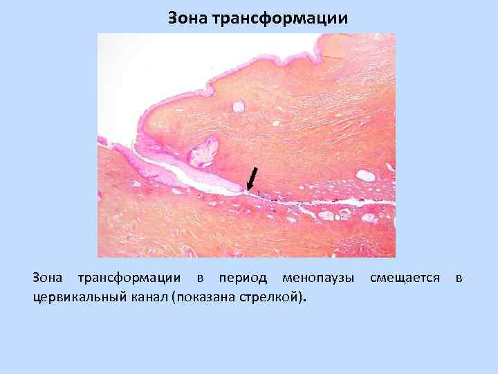 Цервикальный канал картинка