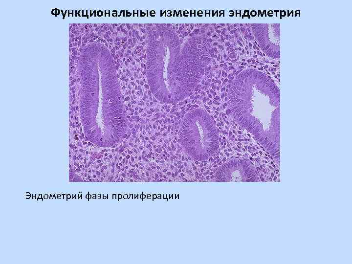 Функциональные изменения эндометрия Эндометрий фазы пролиферации 