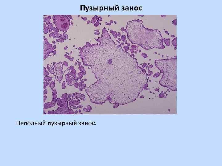 Альбом по патологической анатомии с рисунками