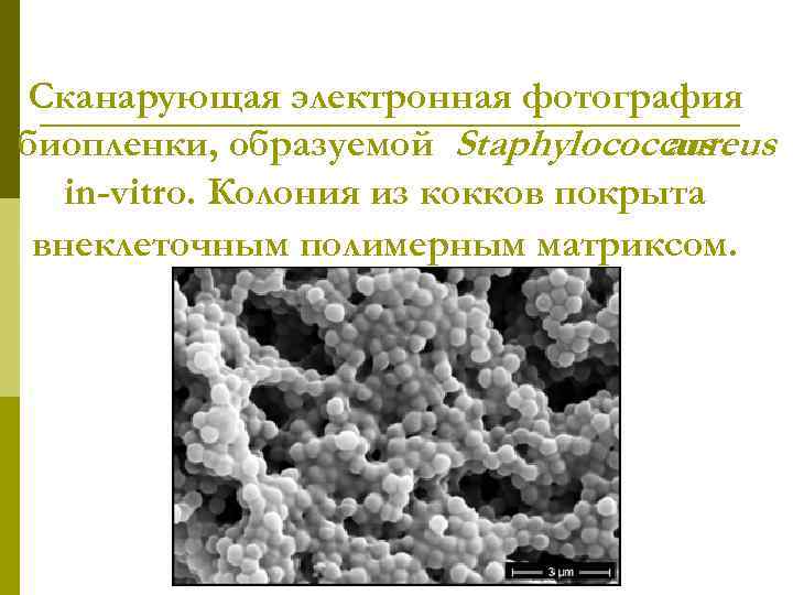 Сканарующая электронная фотография биопленки, образуемой Staphylococcus aureus in-vitro. Колония из кокков покрыта внеклеточным полимерным
