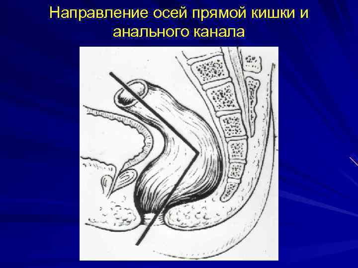 Направление осей прямой кишки и  анального канала 