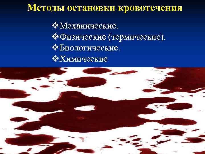 Методы остановки кровотечения v. Механические. v. Физические (термические). v. Биологические. v. Химические Методы остановки кровотечения v. Механические. v. Физические (термические). v. Биологические. v. Химические