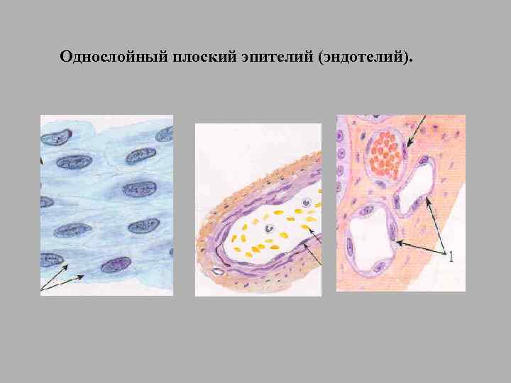Однослойный плоский эпителий (эндотелий). 