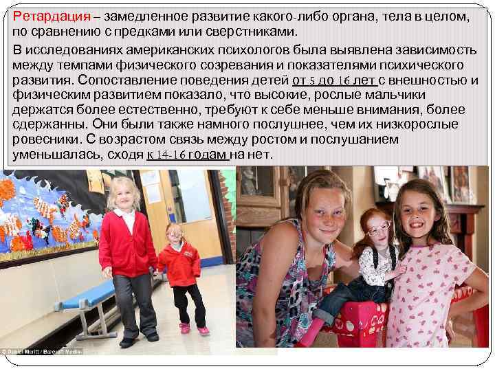 Ретардация – замедленное развитие какого-либо органа, тела в целом, по сравнению с предками или