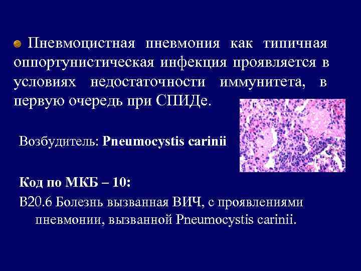 Вич инфекция мкб 10. Пневмоцистная пневмония мкб 10. Пневмоцистная пневмония при ВИЧ патанатомия. Пневмоцистоз патогенез.