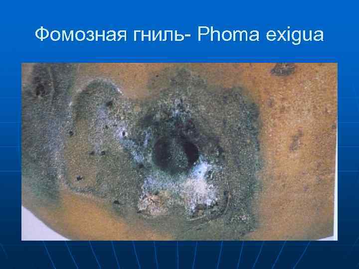 Фомозная гниль- Phoma exigua 