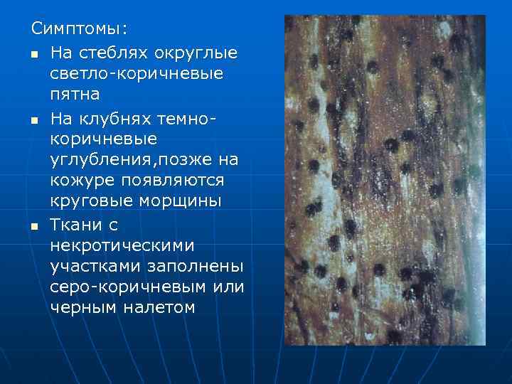 Симптомы: n На стеблях округлые светло-коричневые пятна n На клубнях темнокоричневые углубления, позже на