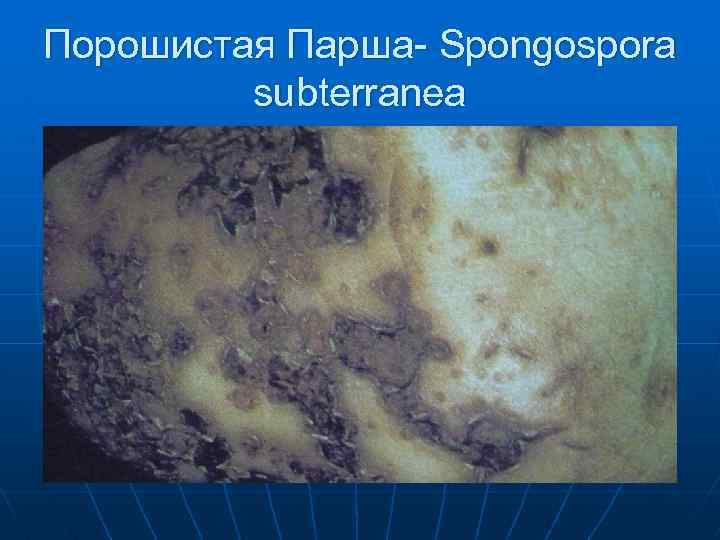 Порошистая Парша- Spongospora subterranea 