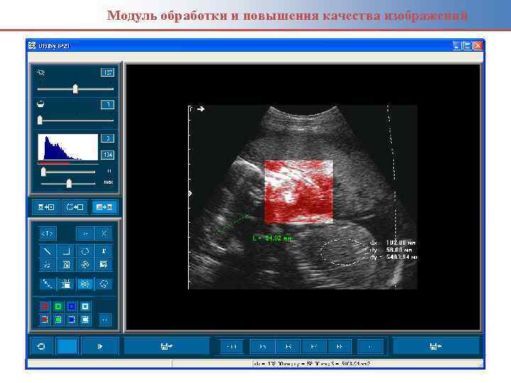 Модуль обработки и повышения качества изображений 44 Хисамутдинов А. Н. , КГМУ 