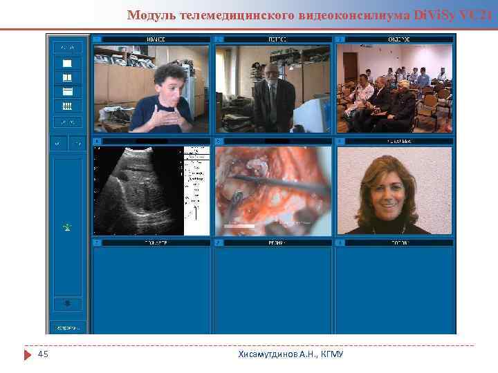 Модуль телемедицинского видеоконсилиума Di. Vi. Sy VC 21 45 Хисамутдинов А. Н. , КГМУ