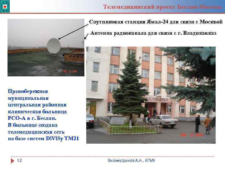 Телемедицинский проект Беслан-Москва Спутниковая станция Ямал-24 для связи с Москвой Антенна радиоканала для связи