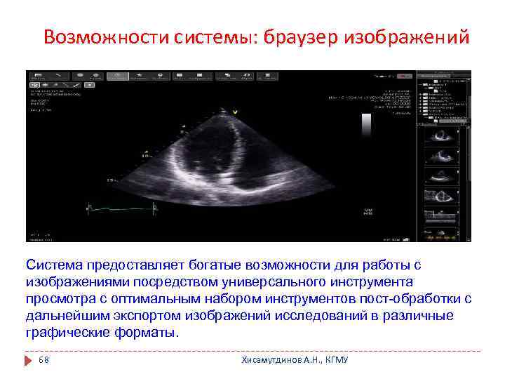 Возможности системы: браузер изображений Система предоставляет богатые возможности для работы с изображениями посредством универсального