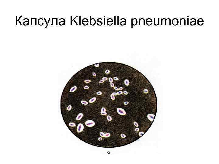 Капсула Klebsiella pneumoniae 