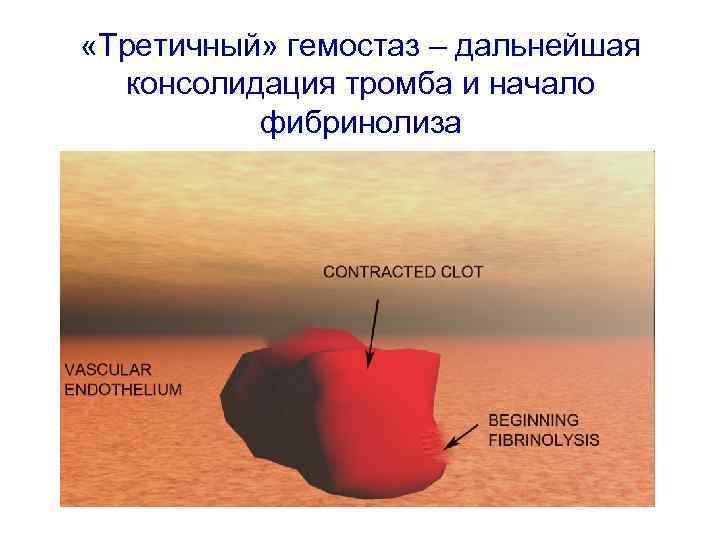  «Третичный» гемостаз – дальнейшая консолидация тромба и начало фибринолиза 