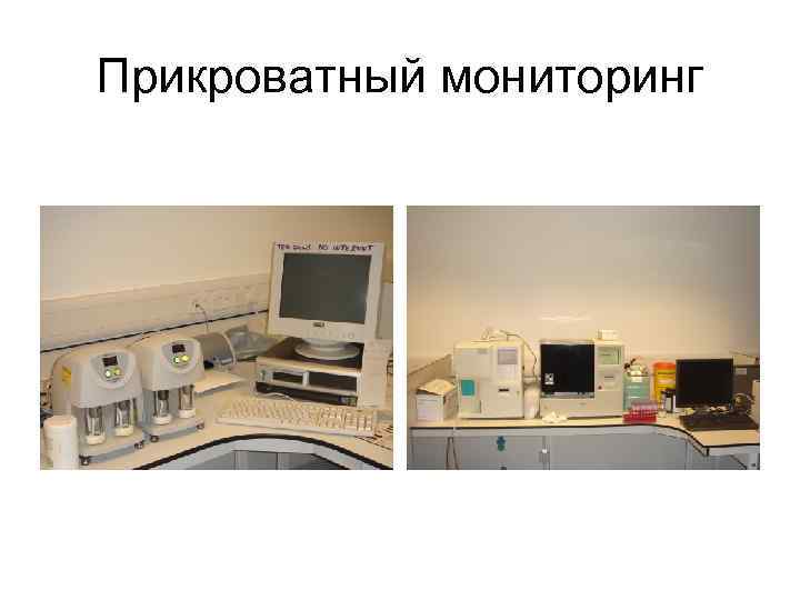 Прикроватный мониторинг 