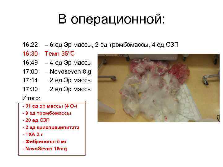 В операционной: 16: 22 16: 30 16: 49 17: 00 17: 14 17: 30