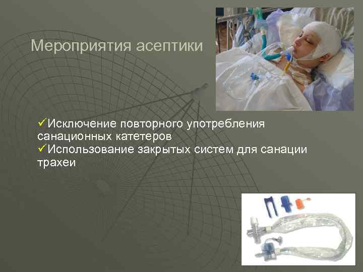 Мероприятия асептики üИсключение повторного употребления санационных катетеров üИспользование закрытых систем для санации трахеи 