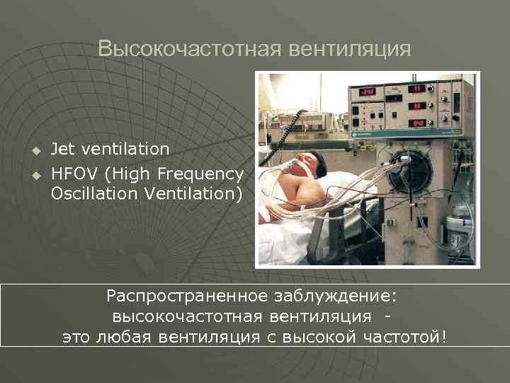  Высокочастотная вентиляция u Jet ventilation u HFOV (High Frequency Oscillation Ventilation) Распространенное заблуждение: