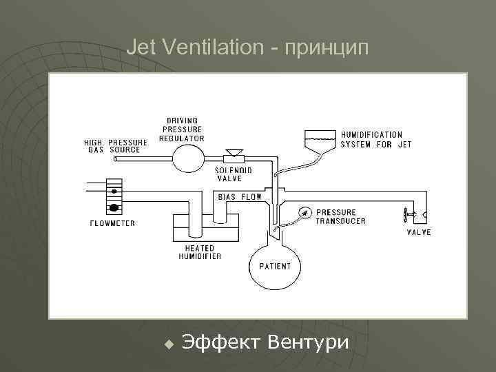 Jet Ventilation - принцип u Эффект Вентури 