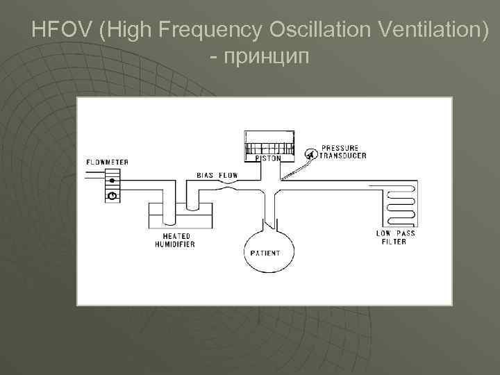 HFOV (High Frequency Oscillation Ventilation) - принцип 