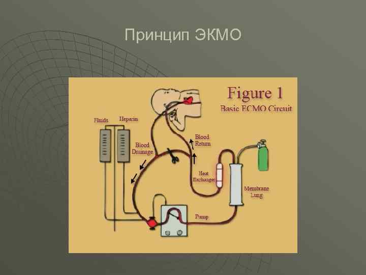 Принцип ЭКМО 