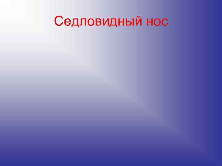 Седловидный нос Седловидный нос