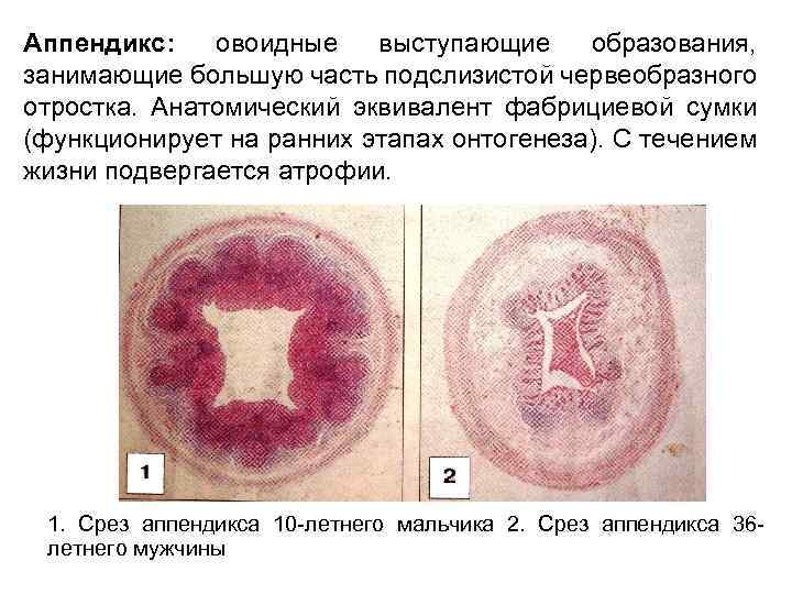 Аппендикс: овоидные выступающие образования, занимающие большую часть подслизистой червеобразного отростка. Анатомический эквивалент фабрициевой сумки