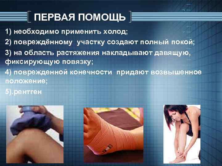 ПЕРВАЯ ПОМОЩЬ 1) необходимо применить холод; 2) повреждённому участку создают полный покой; 3) на