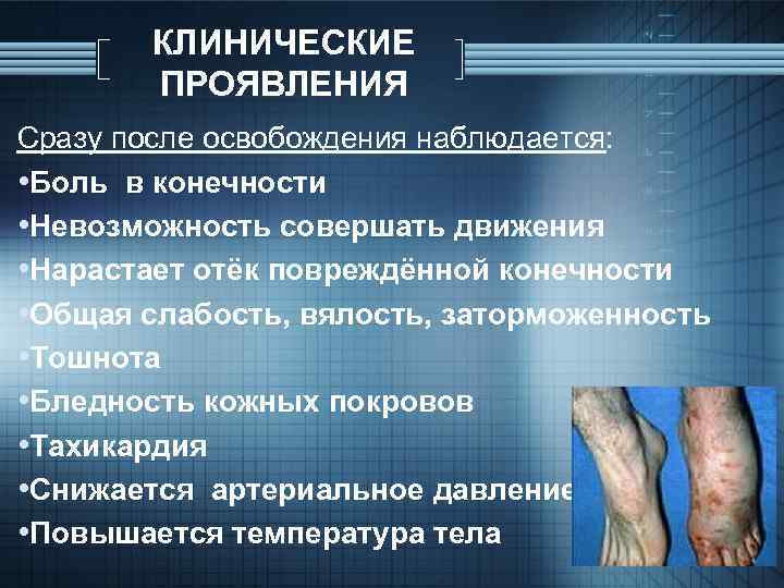 КЛИНИЧЕСКИЕ ПРОЯВЛЕНИЯ Сразу после освобождения наблюдается: • Боль в конечности • Невозможность совершать движения
