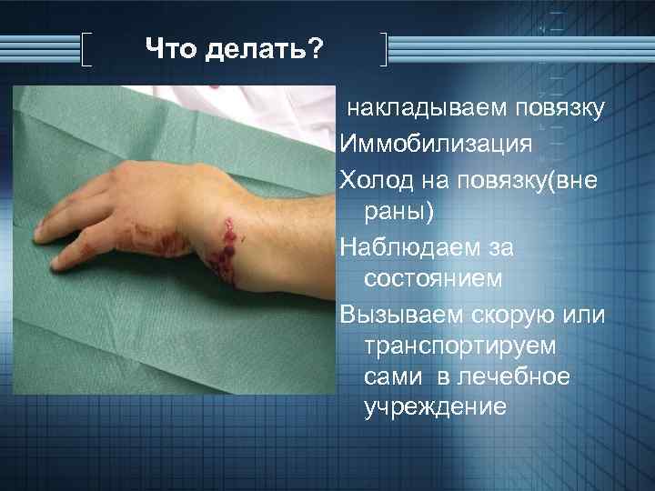 Что делать? накладываем повязку Иммобилизация Холод на повязку(вне раны) Наблюдаем за состоянием Вызываем скорую